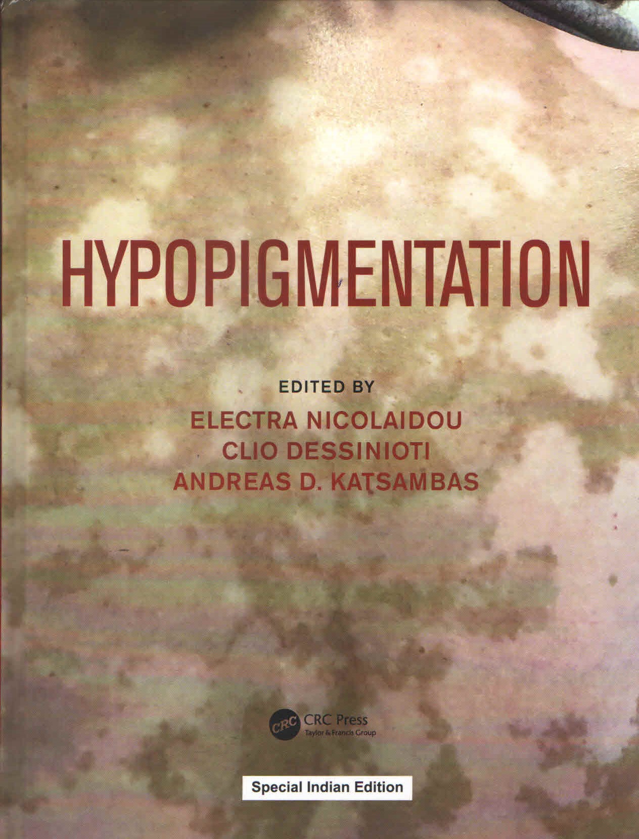 

exclusive-publishers/taylor-and-francis/hypopigmentation-9781032748849
