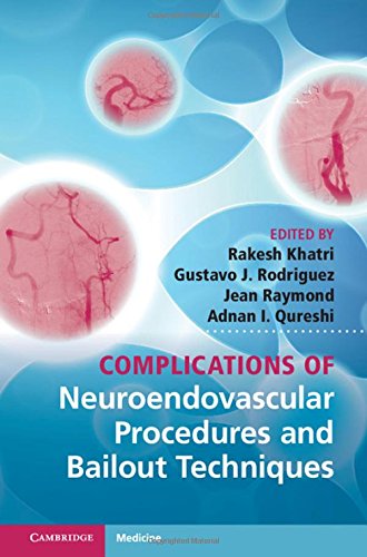

general-books/general/complications-of-neuroendovascular-procedures-and-bailout-techniques--9781107030022