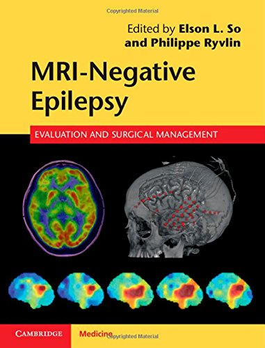 

general-books/general/mri-negative-epilepsy-evaluation-and-surgical-management--9781107034235
