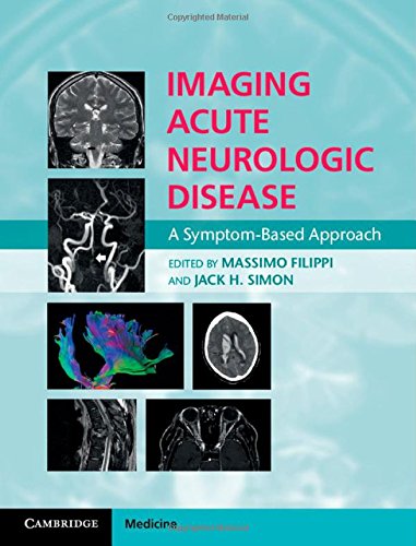 

general-books/general/imaging-acute-neurologic-disease--9781107035942