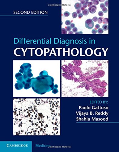 

exclusive-publishers/cambridge-university-press/differential-diagnosis-in-cytopathology-2ed--9781107040298