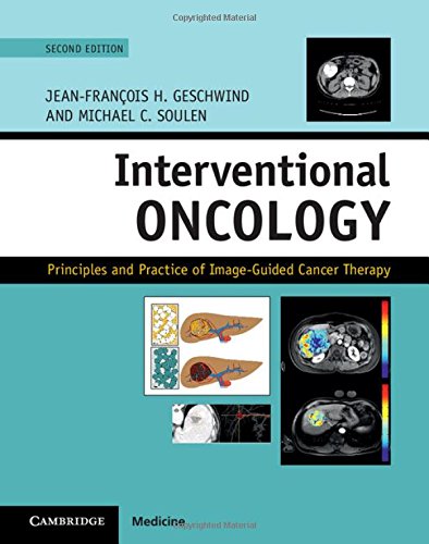 

exclusive-publishers/cambridge-university-press/geschwind-interventional-oncology--9781107043473