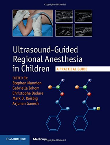 

general-books/general/-ultrasound-guided-regional-anesthesia-in-children-a-practical-guide--9781107098770