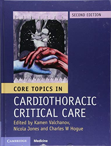 

exclusive-publishers/cambridge-university-press/core-topics-in-cardiothoracic-critical-care-2-ed--9781107131637