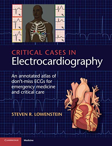 

exclusive-publishers/cambridge-university-press/critical-cases-in-electrocardiography--9781107535916