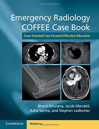 

mbbs/4-year/emergency-radiology-coffee-case-book-9781107690769