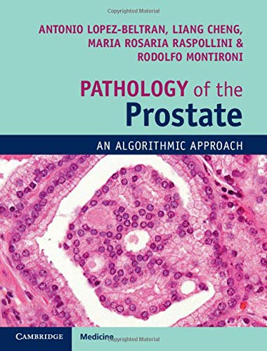 

exclusive-publishers/cambridge-university-press/pathology-of-the-prostate-an-algorithmic-approach--9781108185653