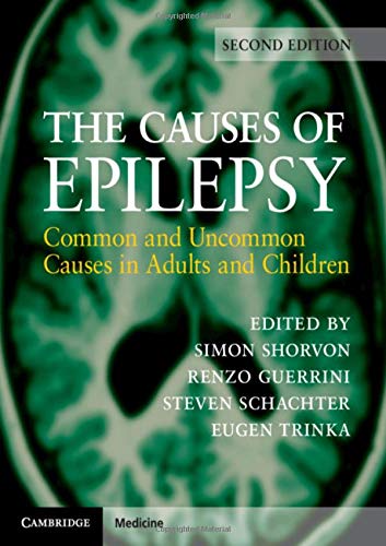 

general-books/general/the-causes-of-epilepsy-9781108420754