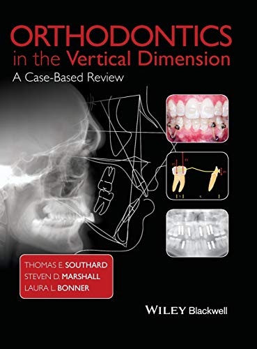 

special-offer/special-offer/orthodontics-in-the-vertical-dimension-a-case-based-review-hb--9781118870211