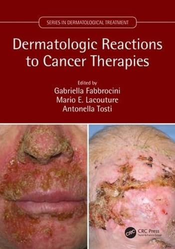 

clinical-sciences/dermatology/dermatologc-reaction-to-cancer-therapies--9781138035539