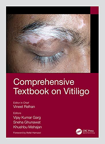 

exclusive-publishers/taylor-and-francis/comprehensive-textbook-on-vitiligo-9781138063594