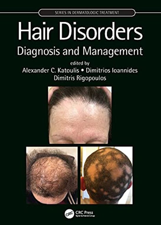 HAIR DISORDERS DIAGNOSIS AND MANAGEMENT
