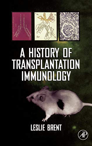 

special-offer/special-offer/a-history-of-transplantation-immunology--9780121317706
