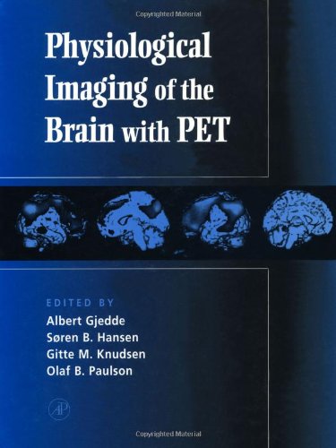 

special-offer/special-offer/physiological-imaging-of-the-brain-with-pet--9780122857515