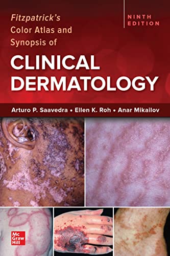 

general-books/general/fitzpatrick-s-color-atlas-synopsis-of-clinical-derma-9-ed-ie--9781265200022