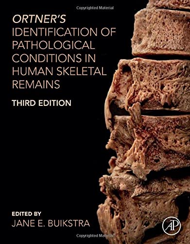 

exclusive-publishers/elsevier/ortner-s-identification-of-pathological-conditions-in-human-skeletal-remains-9780128097380