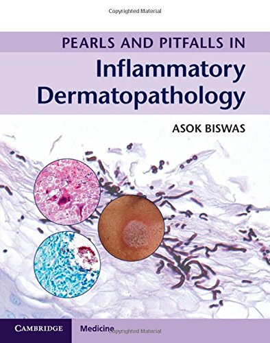 

general-books/general/pearls-and-pitfalls-in-inflammatory-dermatopathology--9781316605998