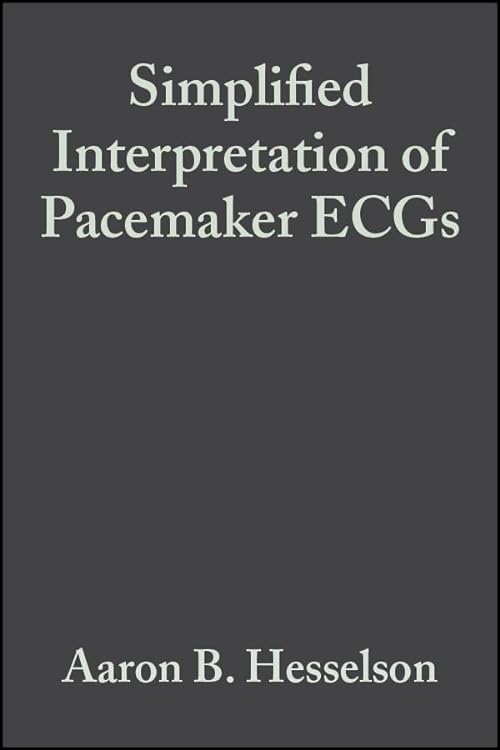 

special-offer/special-offer/simplified-interpretation-of-pacemaker-ecgs--9781405103725