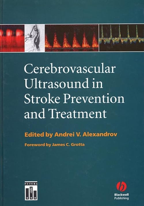 

general-books/general/cerebrovascular-ultrasound-in-stroke-prevention-and-treatment--9781405103817