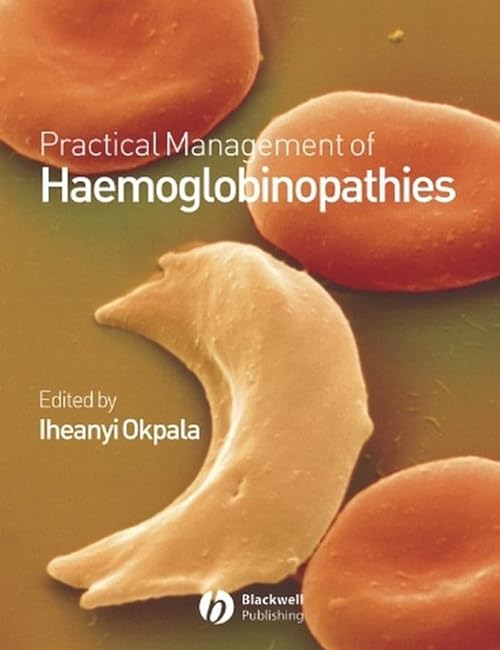 

special-offer/special-offer/practical-management-of-haemoglobinopathies--9781405107808