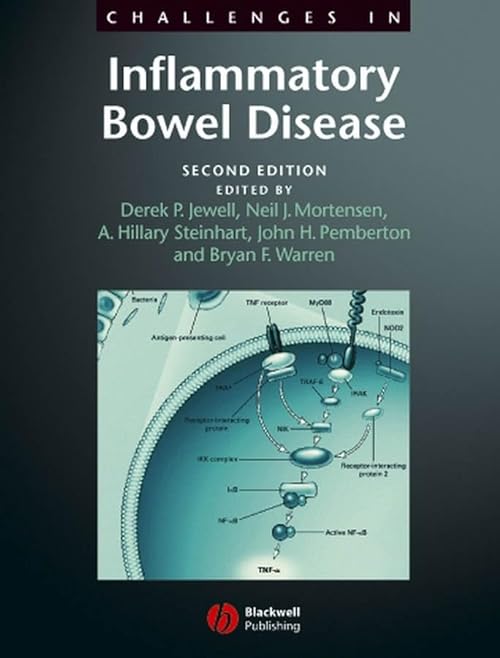 

general-books/general/challenges-in-inflammatory-bowel-disease--9781405122344