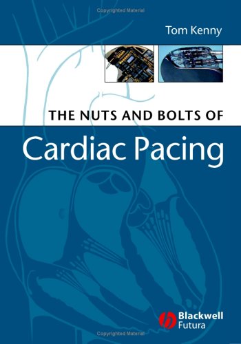 

general-books/general/the-nuts-and-bolts-of-cardiac-pacing-1-ed--9781405132978