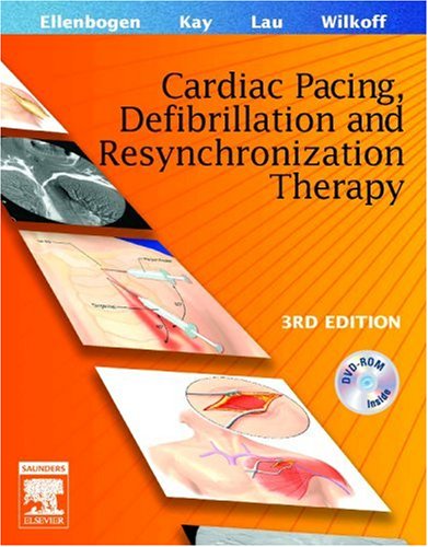 

special-offer/special-offer/clinical-cardiac-pacing-defibrillation-and-resynchronization-therapy-3ed--9781416025368