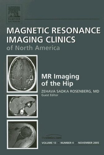 

general-books/general/mr-imaging-of-the-he-hip-magnetic-resonance-imaging-clinics-of-north-amer--9781416027300