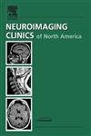 

general-books/general/ophthalmologic-imaging-an-issue-of-neuroimaging-clinics-volume-15-1-1-ed--9781416027324