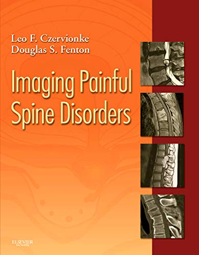 

mbbs/4-year/imaging-painful-spine-disorders---expert-consult-1e-9781416029045