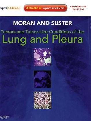 

clinical-sciences/respiratory-medicine/tumors-and-tumor-like-conditions-of-the-lung-and-pleura-expert-consult-online-and-print-9781416036241