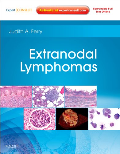 

mbbs/3-year/extranodal-lymphomas-expert-consult---online-and-print-1e-9781416045793