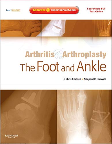 

surgical-sciences/orthopedics/arthritis-and-arthroplasty-the-foot-and-ankle-expert-consult---online-print-and-dvd-9781416049722