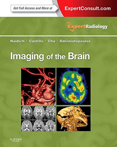 

clinical-sciences/radiology/imaging-of-the-brain-expert-radiology-series-1e-9781416050094