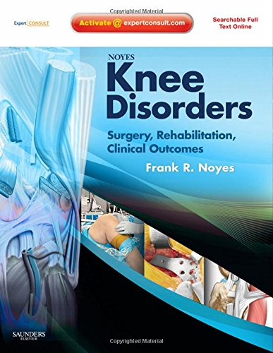 

special-offer/special-offer/noyes-knee-disorders-surgery-rehabiliation-clinical-outcomes-with-dvd--9781416054740
