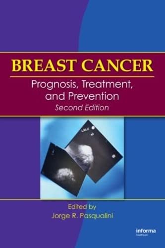 

general-books/general/breast-cacner-prognosis-treatment-and-prevention-2-ed--9781420058727
