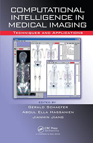 

mbbs/4-year/computational-intelligence-in-medical-imaging-techniques-and-applications-9781420060591