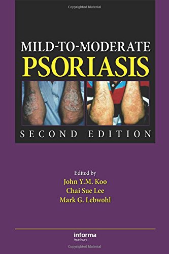 

special-offer/special-offer/mild-to-moderate-psoriasis--9781420088601