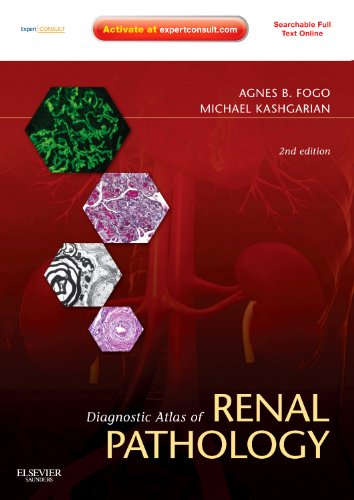 

special-offer/special-offer/diagnostic-atlas-of-renal-pathology-2e-hb--9781437704273