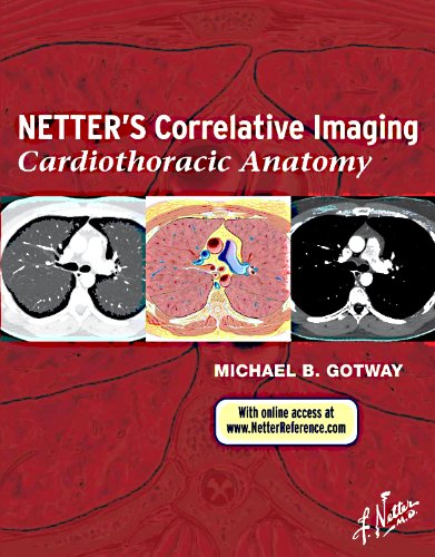 

exclusive-publishers/elsevier/netter-s-correlative-imaging-cardiothoracic-anatomy-with-online-access-1e--9781437704402