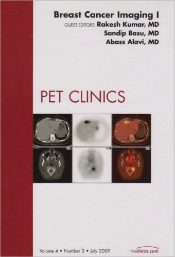 

general-books/general/breast-cancer-imaging-i-an-issue-of-pet-clinics-1--9781437709643