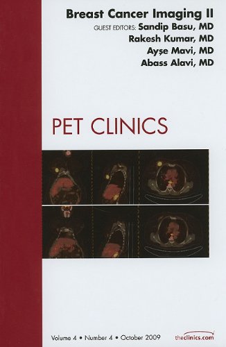 

general-books/general/breast-cancer-imaging-ii-an-issue-of-pet-clinics-1--9781437714029