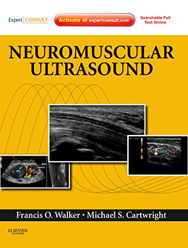 

mbbs/4-year/neuromuscular-ultrasound-expert-consult---online-and-print-1e-9781437715279