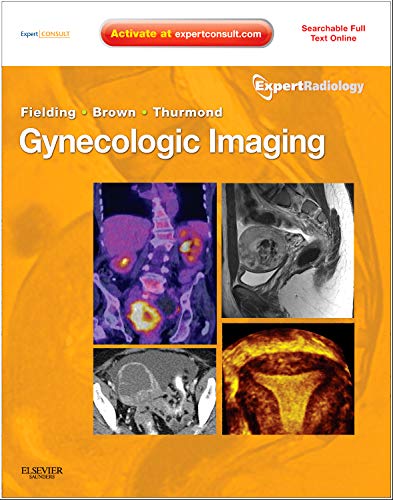 

mbbs/4-year/gynecologic-imaging-expert-radiology-series-1e-9781437715750
