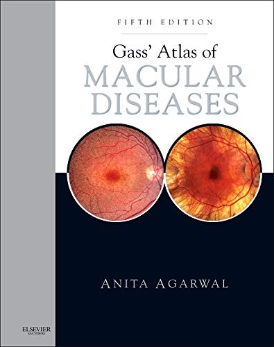 

general-books/general/gass-atlas-of-macular-diseases-5-ed-2-vols--9781437715804