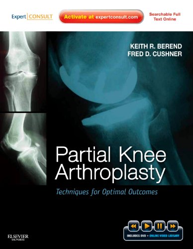 

surgical-sciences/orthopedics/partial-knee-arthroplasty-techniques-for-optimal-outcomes-9781437717563
