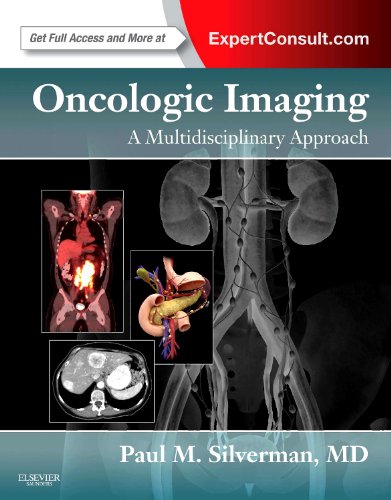 

mbbs/4-year/oncologic-imaging-a-multidisciplinary-approach-expert-consult---online-and-print-1e-9781437722321