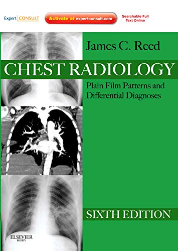 

mbbs/4-year/chest-radiology-plain-film-patterns-and-differential-diagnoses-expert-consult---online-and-print-9781437723458