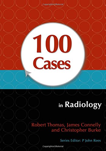 100 CASES IN RADIOLOGY