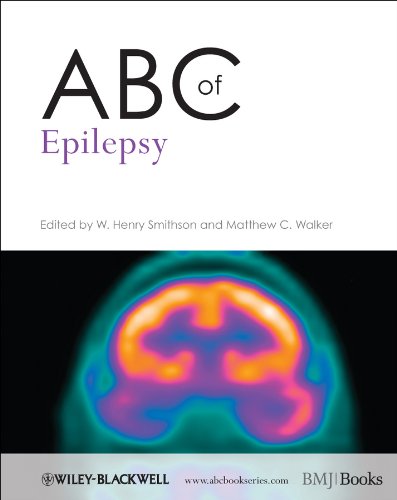 

general-books/general/abc-of-epilepsy-9781444333985